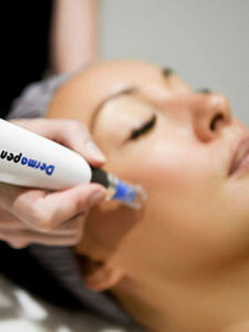 Why should you choose the Beauty Base for your Dermapen services?