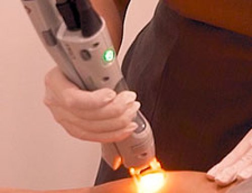 Is Laser Hair Removal right for you?
