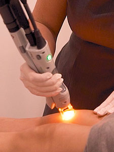 Is Laser Hair Removal right for you?