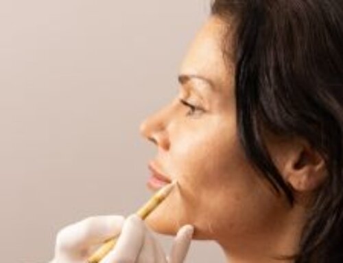 Benefits of Anti-wrinkle injections