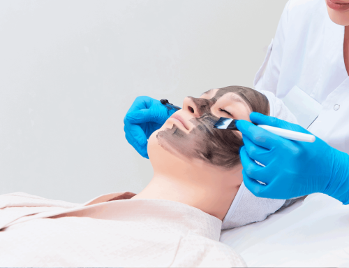 What Is a Carbon Facial?
