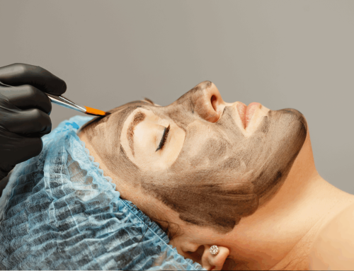 FAQ About Carbon Laser Facial