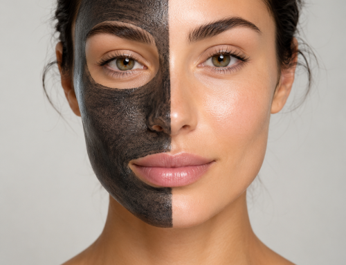 The Main Benefits of a Carbon Facial